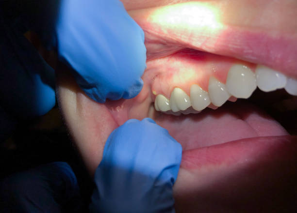 Best Orthodontic Emergency Dentist in Strafford, MO